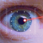 laser, eye, iris-495751.jpg
